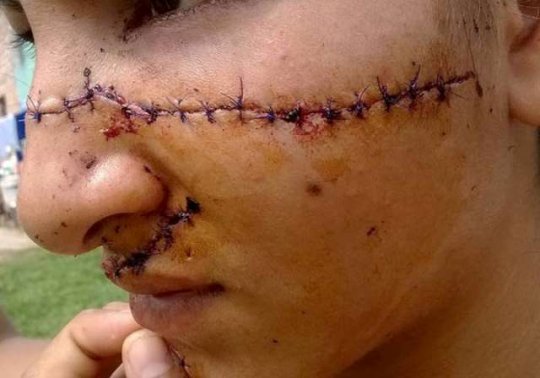 15 yaşlı bacılarını gözəl olduğu üçün doğradılar - FOTO