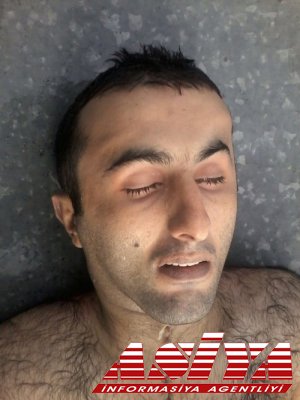 Hərbiçimizin öldürüldüyü təsdiqləndi (FOTOFAKT)
