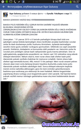 Gənc alimi vəhşicəsinə döyən şəxs hansı vəzifəli polisin oğludur? - Fotolar (Özəl)