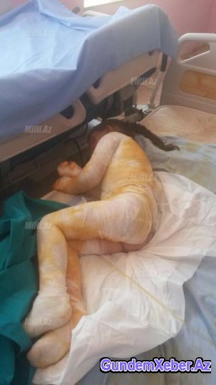 Azərbaycanda bir qığılcımla həyatdan silinən gənc ailə - FOTOLAR (18+)