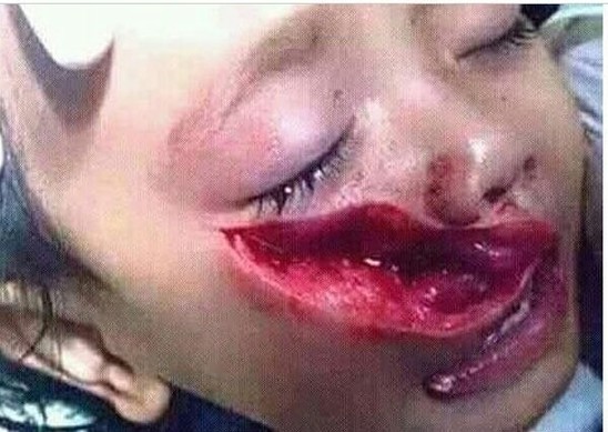 3 yaşlı körpəni ermənilər bu günə saldılar - FOTO 13+