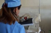 Salyanda doğulan üçəmlərdən sağ qalanı Bakıda həyatını itirdi