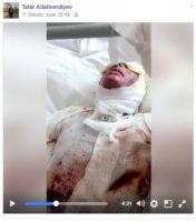  Azərbaycanlı gəlinin üzünə "kislota" tökdülər, dayısını isə soyundurub... +18 VİDEO+FOTO (ÖZƏL)