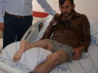 Həkimlər ayağını tərs tikdilər