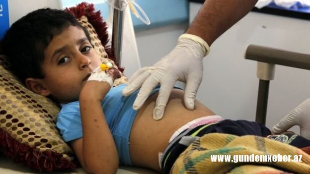 BMT: Yəməndə dünyanın ən dəhşətli vəba epidemiyası tüğyan edir
