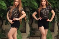Bakıda 22 yaşlı model estetik əməliyyatdan sonra öldü