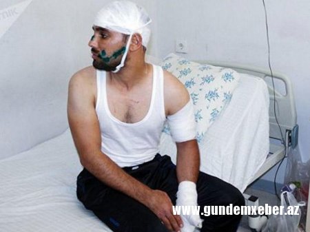 Bakıda gecə qadın müştərisinin evinə gedən taksi sürücüsünün ağzını cırdılar - FOTO