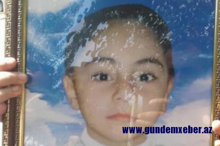 Səhiyyə Nazirliyi it dişləyən 5 yaşlı qızın ölüm səbəbini açıqladı