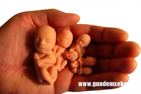Qanunsuz abort edənləri 2 illik həbs cəzası gözləyir