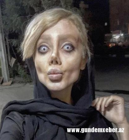Ancelinaya bənzəmək istədi, "insanlıqdan çıxdı" (FOTOLAR)