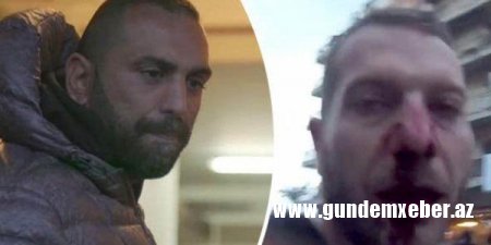 Jurnalistin verdiyi sual ona baha başa gəldi: canlı yayımda burnunu qırdılar (VİDEO)