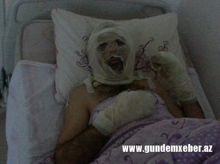 Yol polisi ilə dalaşıb özünü yandıran sürücünün GÖRÜNTÜLƏRİ - TƏFƏRRÜAT (Video+Foto)