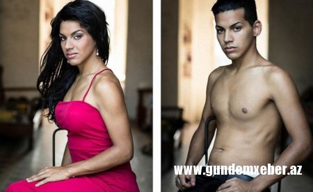 Kişini qadına, qadını kişiyə çevirən genetik sindromlar - 3000 uşaqdan birində rast gəlinir
