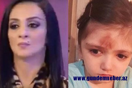 Daha bir döyülən uşaq qalmaqalı – övladını vuran ana həbs edə bilərmi...