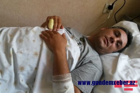 Gəncədə yaralanan polis: “Bu şəxslərin üzərində xəncər və digər kəsici alətlər olduğunu gözləmirdik”