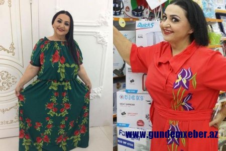 Əməliyyat olunan "Toppuş bacı"nın son halı təəccübləndirdi - Fotolar