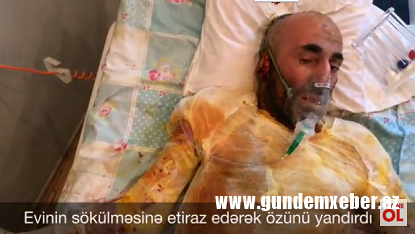 Evinin sökülməsinə etiraz edərək özünü yandıran kişi öldü – Bakıda