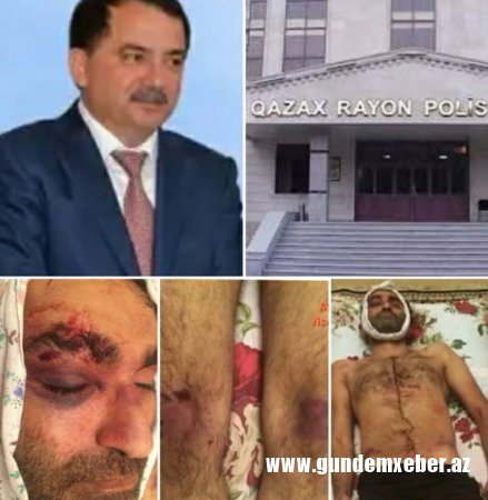 Qazaxda Işgəncə faktı ört-basdır edilir?-ŞOK TƏFƏRRÜAD
