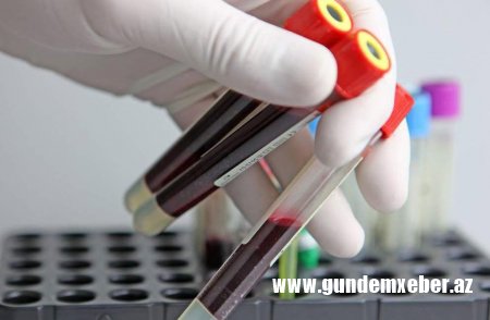 Səhiyyə Nazirliyindən hemofiliyalı xəstələrin dərmanla təminatında yaranmış problemlə əlaqədar AÇIQLAMA