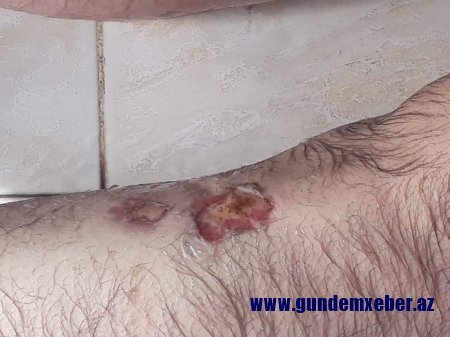 Yasamaldakı “tükürpədici ölüm” faktının gizlinləri-FOTO-VİDEO