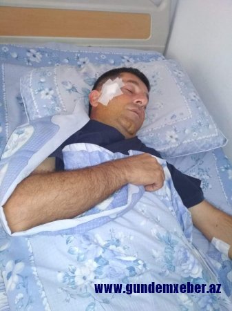 Polisin gözü qarşısında jurnalistə ağır zərbələr endirən şəxslər tam sərbəst buraxıldı-ŞOK OLAY