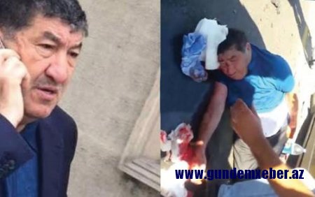 Hacı Mazanla bağlı YENİ XƏBƏR - "Onun müalicəsi bitib, vəziyyəti isə..."