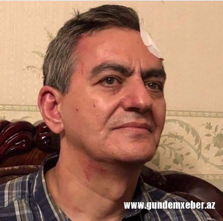 Əli Kərimli sərbəst buraxılıb: "6-7 nəfər məni avtobusda yerə yıxdı, qoluma qandal vurdu və döyməyə başladılar"