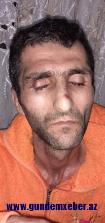 "Qardaşım polislərin verdiyi işgəncədən dünyasını dəyişdi..." - Müəmmalı ölümlə bağlı sensasion iddia	 (FOTOLAR)