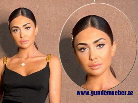 Gözlərini dartdıran Pərvin indi də dodağını böyütdü - FOTO