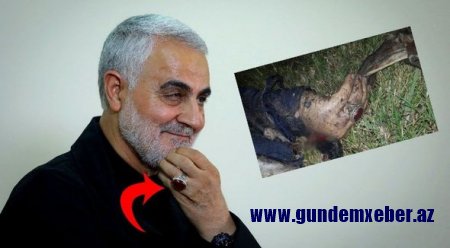 Süleymaninin parçalanmış meyiti barmağındakı üzüyə görə tanınıb - FOTO