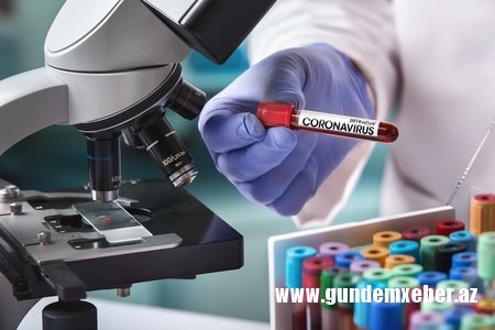 Koronavirus aşkarlanan Azərbaycan vətəndaşlarının yaşları açıqlanıb