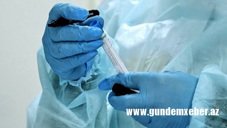 Azərbaycanda daha 29 nəfərdə koronavirus aşkarlandı - Ölən var
