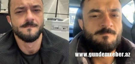 Koronavirusa yoluxan azərbaycanlı gənc: “Heç vaxt belə ağrı hiss etməmişəm”