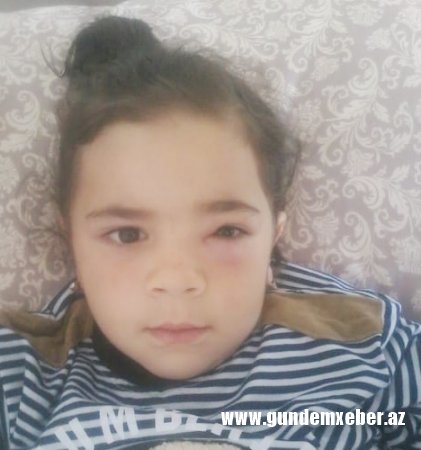 Ölümlə üz-üzə qalan az yaşlı Zəhraya görə prezidentə müraciət edildi - FOTO/VİDEO