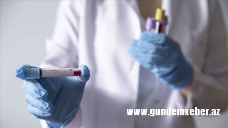 Azərbaycanda daha bir nəfər koronavirusdan öldü, 50 yeni yoluxma