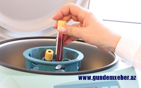 Azərbaycanda daha 56 nəfərdə koronavirus aşkarlandı - 53 nəfər sağaldı