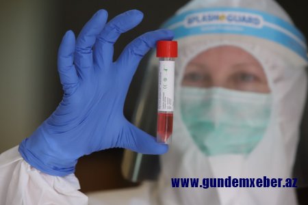 Azərbaycanda daha 38 nəfər koronavirusa yoluxub, 42 nəfər sağalıb