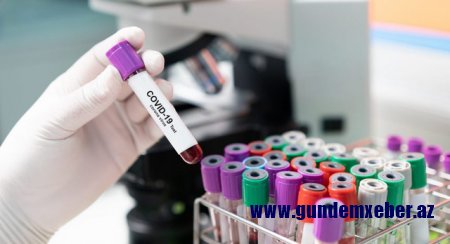 Azərbaycanda daha 25 nəfər koronavirusa yoluxub, 67 nəfər sağalıb
