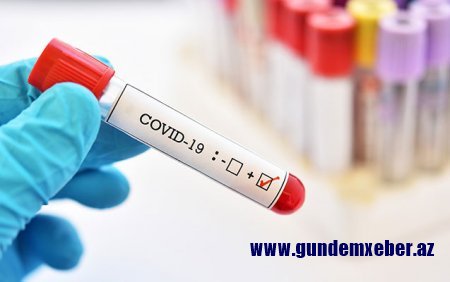 Azərbaycanda daha 113 nəfər yoluxdu, 2 nəfər vəfat etdi