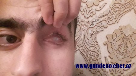 Sahil Babayev xalqı barmağına doladığı kimi, ölkə rəhbərliyini də saymır – Şikayət