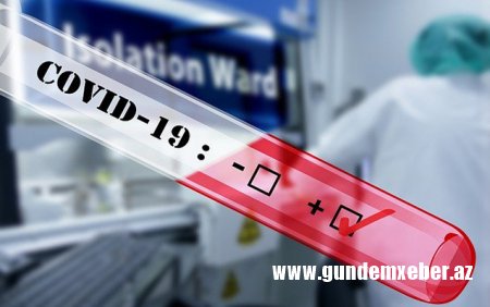 Azərbaycanda daha 158 nəfər koronavirusa yoluxdu - 58 pasiyent sağaldı