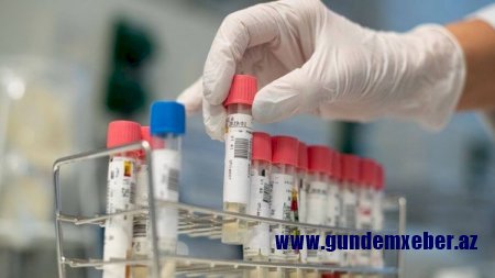 Azərbaycanda daha 113 nəfərdə koronavirus aşkarlandı - Ölən var