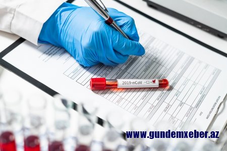 Azərbaycanda daha 338 nəfər koronavirusa yoluxub, 4 nəfər ölüb