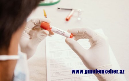 Azərbaycanda daha 352 nəfər koronavirusa yoluxdu, 6 nəfər öldü