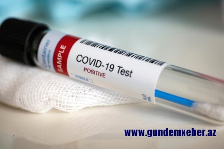 Azərbaycanda koronavirusla bağlı testlərin sayı açıqlanıb - RƏSMİ