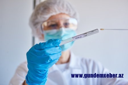 Rusiyada koronavirusdan ölənlərin sayı 9 500 nəfəri keçdi