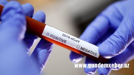 Koronavirusla bağlı PİS XƏBƏR — TƏSDİQLƏNDİ