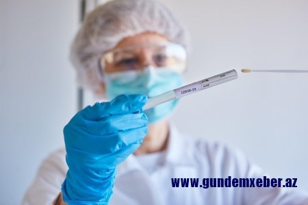 Ermənistanda koronavirusa yoluxanların sayı 38 minə çatır