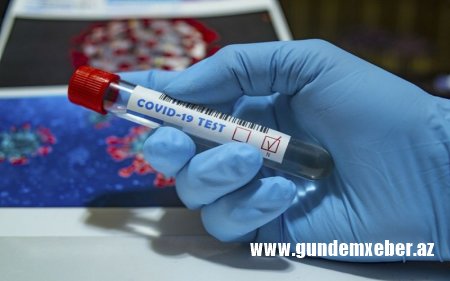 Son sutka ərzində 6 318 test aparılıb - Azərbaycanda