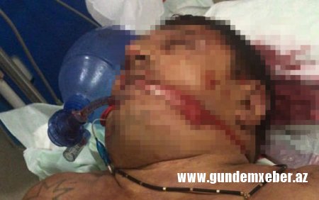 “Lotu Quli”nin vurulduqdan sonrakı görüntüləri yayılıb - FOTO